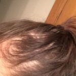 63 Shampoo - Clinically Proven, Stops Hair Loss, Promotes Regrowth, and Thickens Hair photo review
