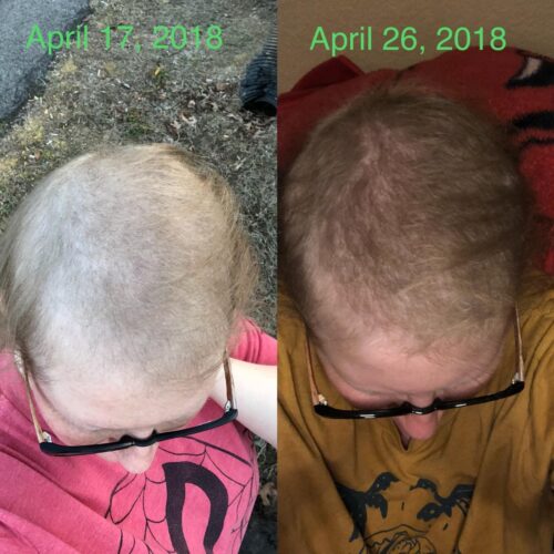 63 Shampoo - Clinically Proven, Stops Hair Loss, Promotes Regrowth, and Thickens Hair photo review
