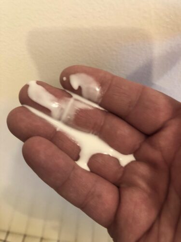 Anti-Acne & Pimple Treatment - Proven Formula for Clear, Healthy Skin photo review