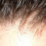 REKZE 24 Hair Growth Serum - Clinically Proven to Reduce Hair Loss & Thicken Hair photo review