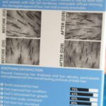 REKZE 24 Hair Growth Serum - Clinically Proven to Reduce Hair Loss & Thicken Hair photo review